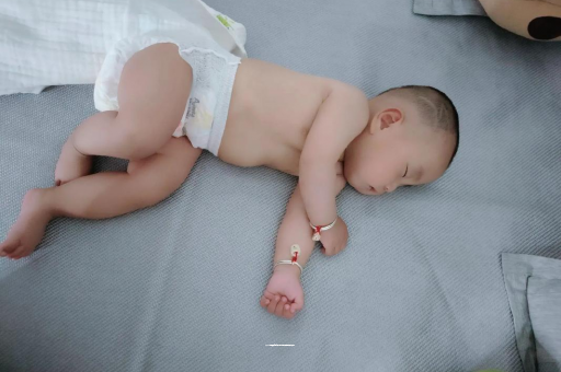 阳泉宝宝褶皱处擦粉还是油